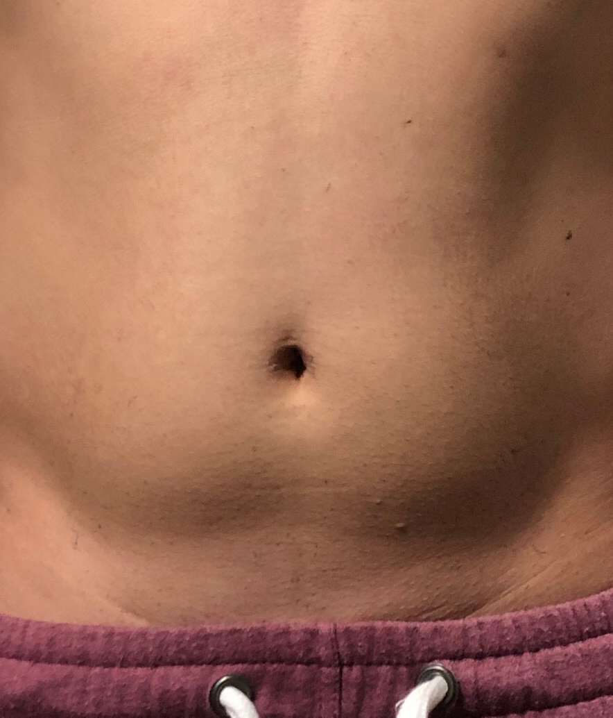 ﾑﾀﾞ毛処理の革命品 ﾐｭｾﾞ 薬用ﾍｱﾘﾑｰﾊﾞﾙｸﾘｰﾑ を剛毛男性が使ってみた コネブロ